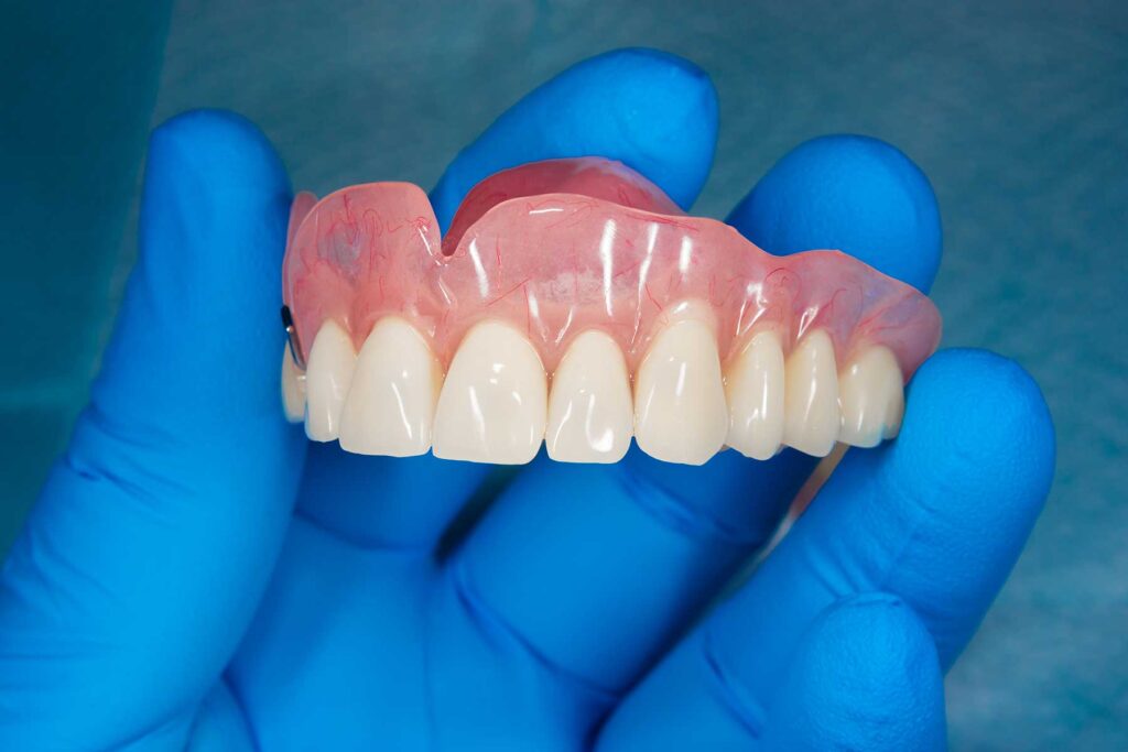 Prosthodontist's hand holding dentures while providing denture services for low-income patients