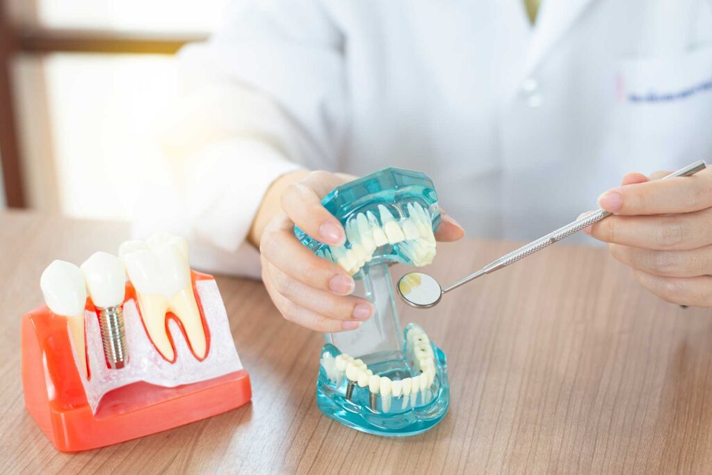 Prosthodontist examining models of affordable dental implants